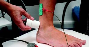 Ultraschall Plus Therapie an der Achillessehne